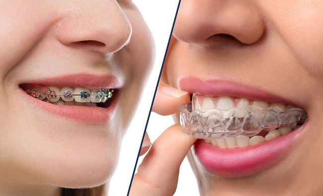 Top 10 Phòng Khám Niềng Răng Đà Nẵng