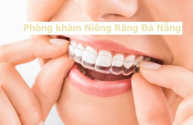 Top 10 Phòng Khám Niềng Răng Đà Nẵng